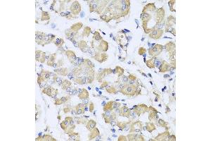 Immunohistochemistry of paraffin-embedded human gastric using L2HGDH antibody at dilution of 1:100 (x40 lens). (L2HGDH Antikörper)