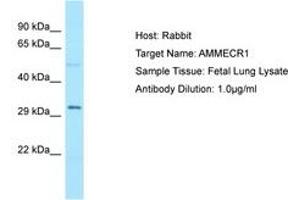 Image no. 1 for anti-Alport Syndrome, Mental Retardation, Midface Hypoplasia and Elliptocytosis Chromosomal Region Gene 1 (AMMECR1) (C-Term) antibody (ABIN6749952)