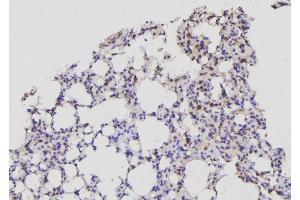 ABIN6269341 at 1/100 staining Mouse lung tissue by IHC-P. (Acetyl-CoA Carboxylase alpha Antikörper  (N-Term))