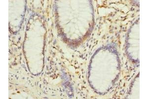 Immunohistochemistry (IHC) image for anti-PHD Finger Protein 1 (PHF1) (AA 151-360) antibody (ABIN7163042)