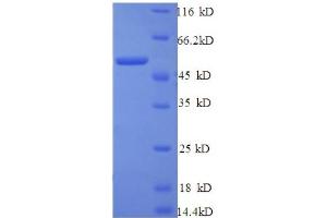 SDS-PAGE (SDS) image for Tyrosinase-Related Protein 1 (TYRP1) (AA 82-333), (partial) protein (GST tag) (ABIN5712506)