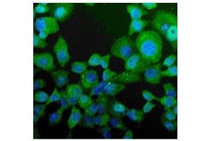 IF analysis of NPC2 using anti-NPC2 antibody (ABIN7600520).