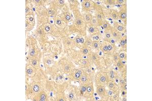 Immunohistochemistry of paraffin-embedded human liver injury using IMPA1 antibody at dilution of 1:100 (x40 lens). (IMPA1 Antikörper)
