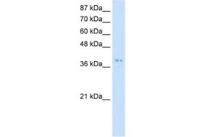 Western Blotting (WB) image for anti-Protein Arginine Methyltransferase 1 (PRMT1) antibody (ABIN2462043) (PRMT1 Antikörper)