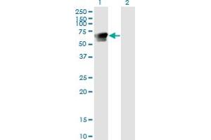 Western Blot analysis of GRB7 expression in transfected 293T cell line by GRB7 monoclonal antibody (M03), clone 3C12.