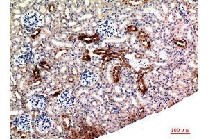 Immunohistochemistry (IHC) analysis of paraffin-embedded Rat Kidney, antibody was diluted at 1:100.