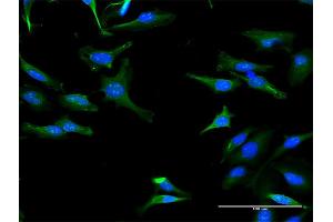 Immunofluorescence of purified MaxPab antibody to TRIT1 on HeLa cell.