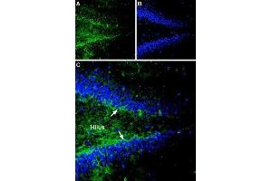 Expression of Gephyrin in rat hippocampusImmunohistochemical staining of rat hippocampal dentate gyrus sections using Anti-Gephyrin Antibody (ABIN7043214, ABIN7044520 and ABIN7044521).