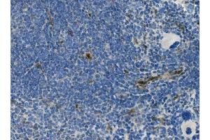 IHC analysis of MCAM using anti-MCAM antibody (ABIN7601026).