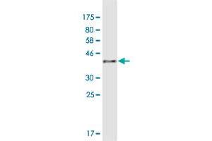 Western Blot detection against Immunogen (41 KDa) . (AKR1CL1 Antikörper  (AA 1-129))