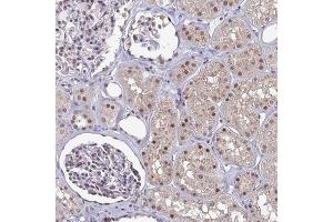 Immunohistochemical staining of human kidney with ATF1 polyclonal antibody  shows moderate nuclear positivity in renal tubules and cells in glomeruli.