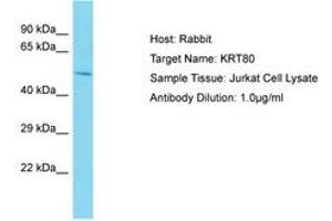 Image no. 1 for anti-Keratin 80 (KRT80) (AA 57-106) antibody (ABIN6750577) (KRT80 Antikörper  (AA 57-106))