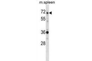 Western Blotting (WB) image for anti-SH3-Domain Binding Protein 2 (SH3BP2) antibody (ABIN2998912) (SH3BP2 Antikörper)