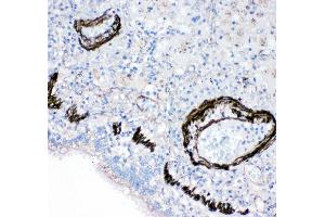 Immunohistochemistry (IHC) image for anti-Fatty Acid Binding Protein 6, Ileal (FABP6) (AA 15-33), (N-Term) antibody (ABIN3042864)