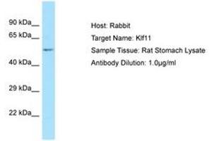 Image no. 1 for anti-Kruppel-Like Factor 11 (KLF11) (N-Term) antibody (ABIN6749845) (KLF11 Antikörper  (N-Term))