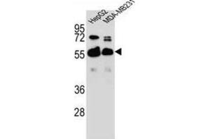 Western Blotting (WB) image for anti-RAP1, GTP-GDP Dissociation Stimulator 1 (RAP1GDS1) antibody (ABIN2996449) (RAP1GDS1 Antikörper)