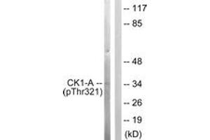 Western blot analysis of extracts from HuvEc cells, using Casein Kinase I alpha (Phospho-Tyr321) Antibody. (CSNK1A1 Antikörper  (pThr321))