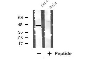 Western blot analysis of extracts from HeLa cells, using CTSD antibody. (Cathepsin D Antikörper  (C-Term))