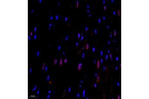Immunofluorescence of paraffin embedded mouse heart using CITED4 (ABIN7073356) at dilution of 1:2200 (400x lens) (CITED4 Antikörper)