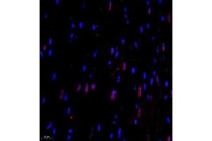 Immunofluorescence of paraffin embedded mouse heart using CITED4 (ABIN7073356) at dilution of 1:2200 (400x lens) (CITED4 Antikörper)