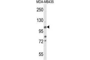 Western Blotting (WB) image for anti-Lysine (K)-Specific Demethylase 4B (KDM4B) antibody (ABIN3004253) (KDM4B Antikörper)