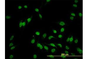 Image no. 3 for anti-Hairy/enhancer-of-Split Related with YRPW Motif-Like (HEYL) (AA 221-327) antibody (ABIN599209) (HEYL Antikörper  (AA 221-327))