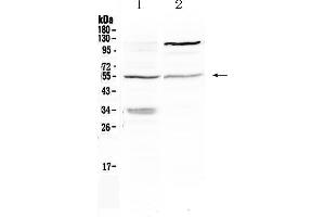 Western blot analysis of ETS1 using anti- ETS1 antibody .