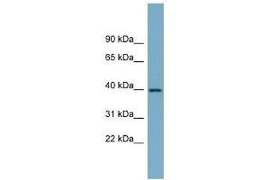 SULT2B1 antibody used at 1 ug/ml to detect target protein. (SULT2B1 Antikörper  (N-Term))