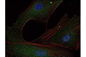 Immunofluorescence staining of Fyn in human primary fibroblasts using anti-Fyn (; green). (FYN Antikörper  (AA 7-176))