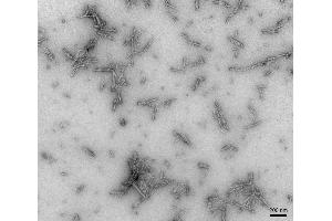 TEM of Type 2 Alpha Synuclein Pre-formed Fibrils (PFFs) (ABIN5065824) (SNCA Protein (full length))