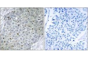 Immunohistochemistry (IHC) image for anti-Ets Variant 4 (ETV4) (AA 281-330) antibody (ABIN2889480) (ETV4 Antikörper  (AA 281-330))