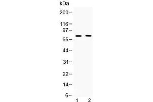 Western blot testing of 1) rat thymus and 2) human COLO320 lysate with TRF2 antibody at 0. (TRF2 Antikörper)