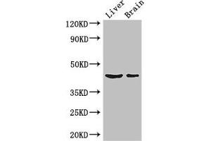 Western Blot Positive WB detected in: Mouse liver tissue, Mouse brain tissue All lanes: METTL2A antibody at 3 μg/mL Secondary Goat polyclonal to rabbit IgG at 1/50000 dilution Predicted band size: 44, 28 kDa Observed band size: 44 kDa (METTL2A Antikörper  (AA 1-242))