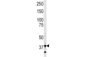 Western Blotting (WB) image for anti-Annexin A5 (ANXA5) (AA 262-291) antibody (ABIN3002694) (Annexin V Antikörper  (AA 262-291))