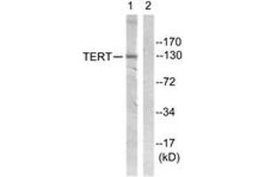 Western blot analysis of extracts from Jurkat cells, using Telomerase (Ab-824) Antibody. (TERT Antikörper  (AA 796-845))