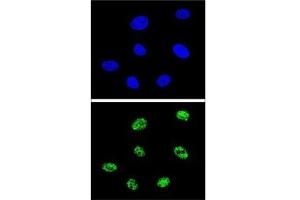 Immunofluorescence (IF) image for anti-Tumor Protein P73 (TP73) (AA 288-317) antibody (ABIN3029400)