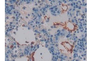 DAB staining on IHC-P; Samples: Rat Lung Tissue