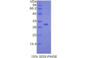 SDS-PAGE analysis of Mouse Fibulin 4 Protein.