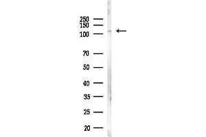 Western blot analysis of lysates from PC12 cells(LPS, 4h treatment), using SRPK2 Antibody at 1/1000 dilution.