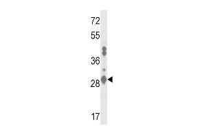 Western blot analysis of GSTA2 Antibody (N-term) (ABIN653362 and ABIN2842838) in MDA-M cell line lysates (35 μg/lane). (GSTa2 Antikörper  (N-Term))