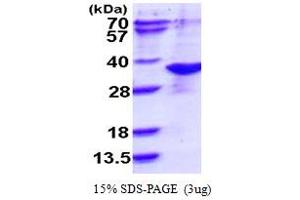 SDS-PAGE (SDS) image for ARD1 Homolog, N-Acetyltransferase (ARD1A) (AA 1-235) protein (His tag) (ABIN667945)