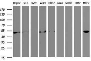 Image no. 6 for anti-Selenium Binding Protein 1 (SELENBP1) antibody (ABIN1500864)