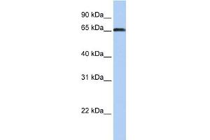 WB Suggested Anti-ZXDC Antibody Titration:  0. (ZXDC Antikörper  (Middle Region))