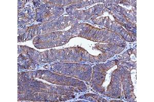 IHC analysis of LIN41/TRIM71 using anti-LIN41/TRIM71 antibody (ABIN7602565).
