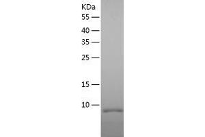Western Blotting (WB) image for ethanolaminephosphotransferase 1 (CDP-Ethanolamine-Specific) (EPT1) (AA 1-26) protein (His tag) (ABIN7122822)