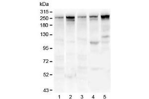 Western blot testing of 1) rat lung, 2) mouse lung, 3) human U-87 MG, 4) human MDA-MB-231 and 5) human HepG2 lysate with Talin 1 antibody. (TLN1 Antikörper)