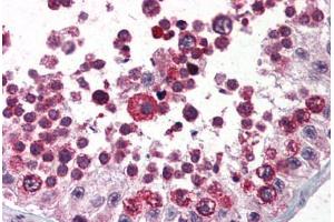 Human Testis (formalin-fixed, paraffin-embedded) stained with AATF antibody ABIN214394 at 2.