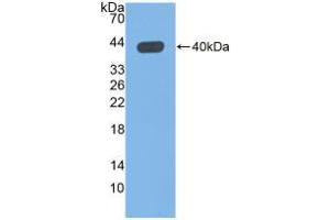 Western blot analysis of recombinant Human QPCT. (QPCT Antikörper  (AA 29-361))