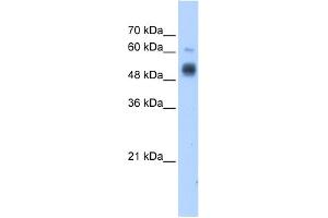 WB Suggested Anti-GCNT3 Antibody Titration:  1.