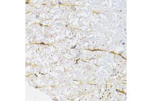 Immunohistochemistry of paraffin-embedded rat spinal cord using KIF1B Antibody.